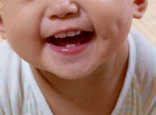 Hậu quả của việc cho tay vào miệng khi trẻ mới mọc răng 